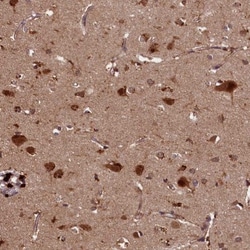 NRAMP2/SLC11A2/DMT1 Antibody, Novus Biologicals:Antibodies:Primary Antibodies
